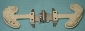 Traditional dental impression apparatus