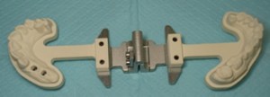 Traditional dental impression apparatus