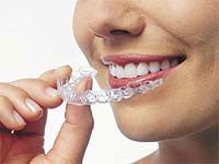 Woman with Invisalign